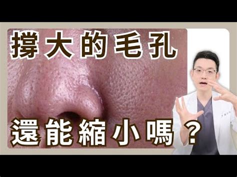 臉頰長白毛|如何化解左臉長白毛的厄運？